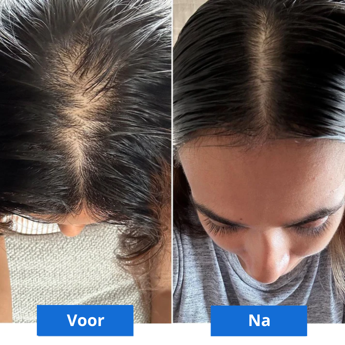 Scalp Bliss – Masseur Cuir Chevelu Luxe Détente