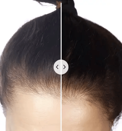 ChicBlend – Peigne 5-en-1 Soin Cuir Chevelu